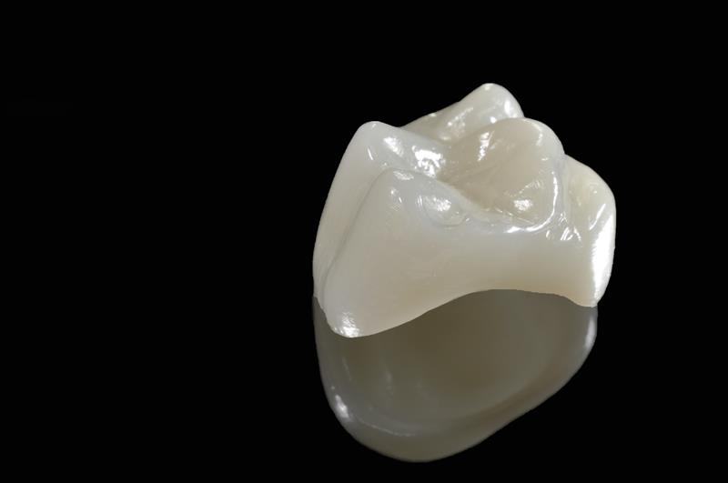 Porcelain Crowns  Butler, IN 